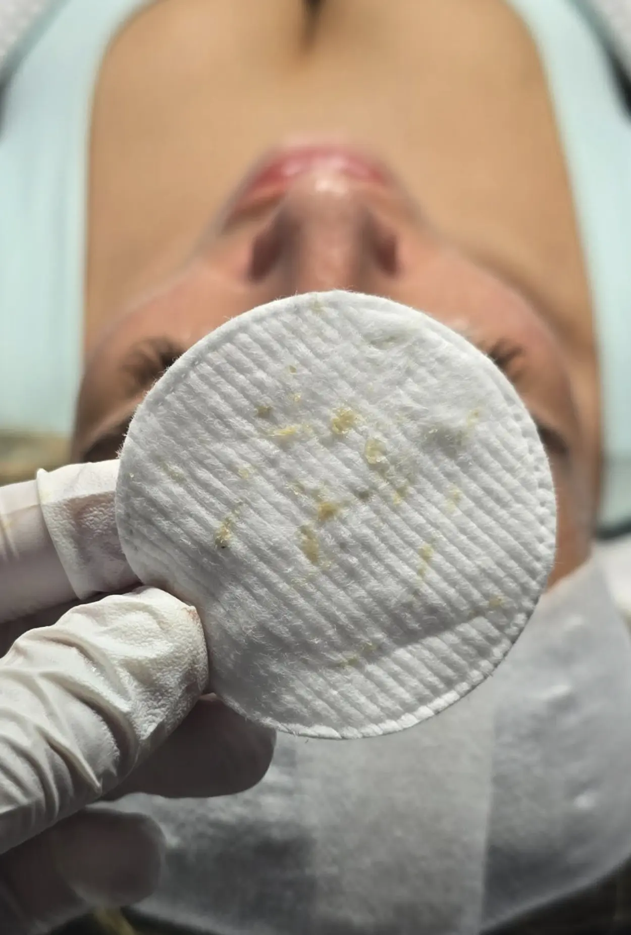 Refuge San Urbez | Does Microdermabrasion Help Fade Old “Fine-Line” Tattoos Or Cosmetic Brow Shading? dermaplaning course manchester